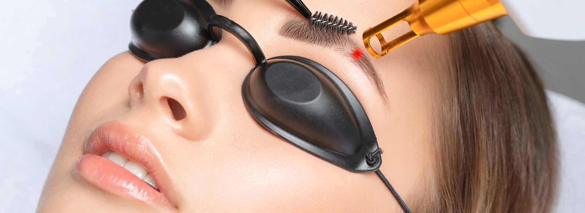 Tattoo Laser Removal Shrewsbury